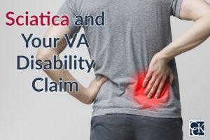 Sciatica and Your VA Disability Claim
