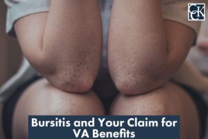 Bursitis and Your Claim for VA Benefits