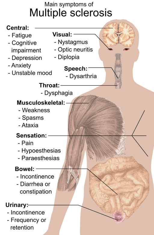 Symptoms of multiple sclerosis
