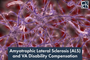 Amyotrophic Lateral Sclerosis (ALS) and VA Disability Compensation
