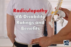 Radiculopathy VA Disability Ratings and Benefits