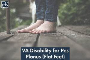 VA Disability Ratings for Pes Planus (Flat Feet)