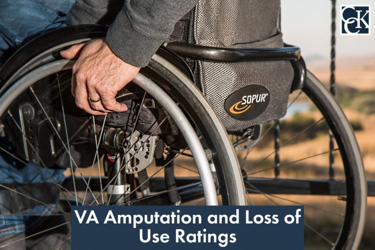 VA Amputation and Loss of Use Ratings