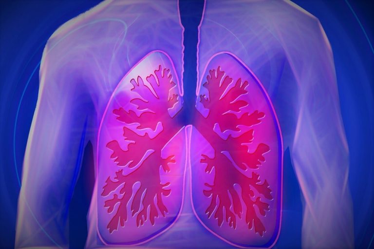 Deployment-related lung disease
