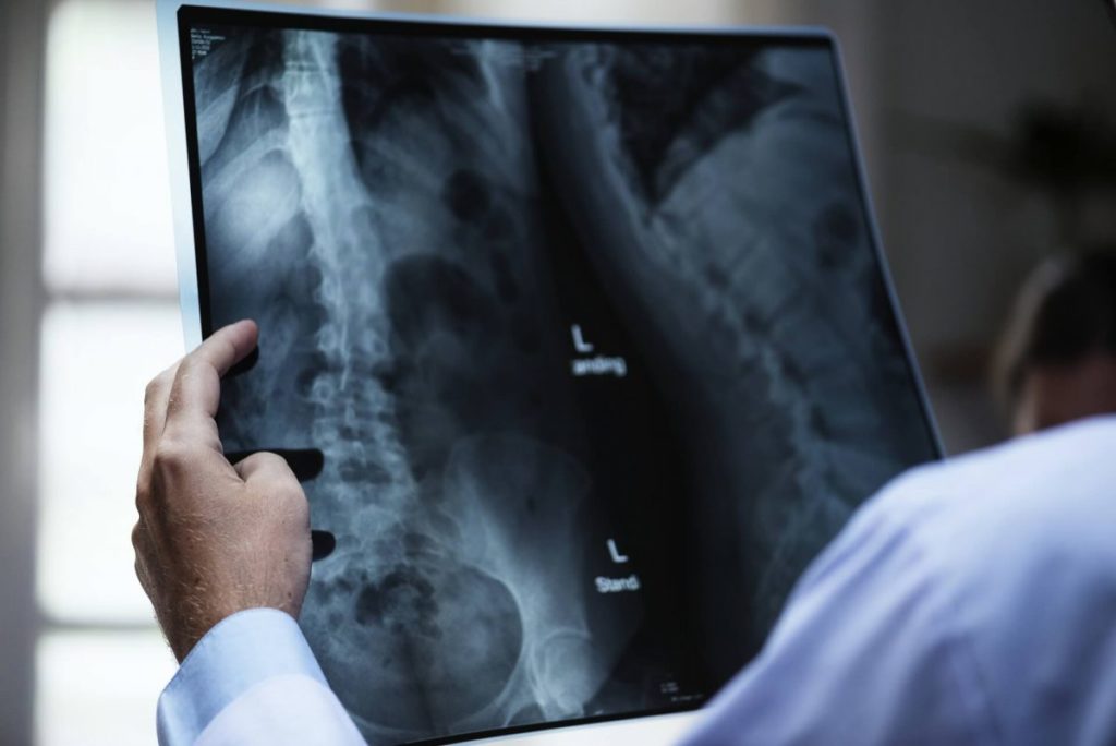Undiagnosed Illness Persian Gulf War