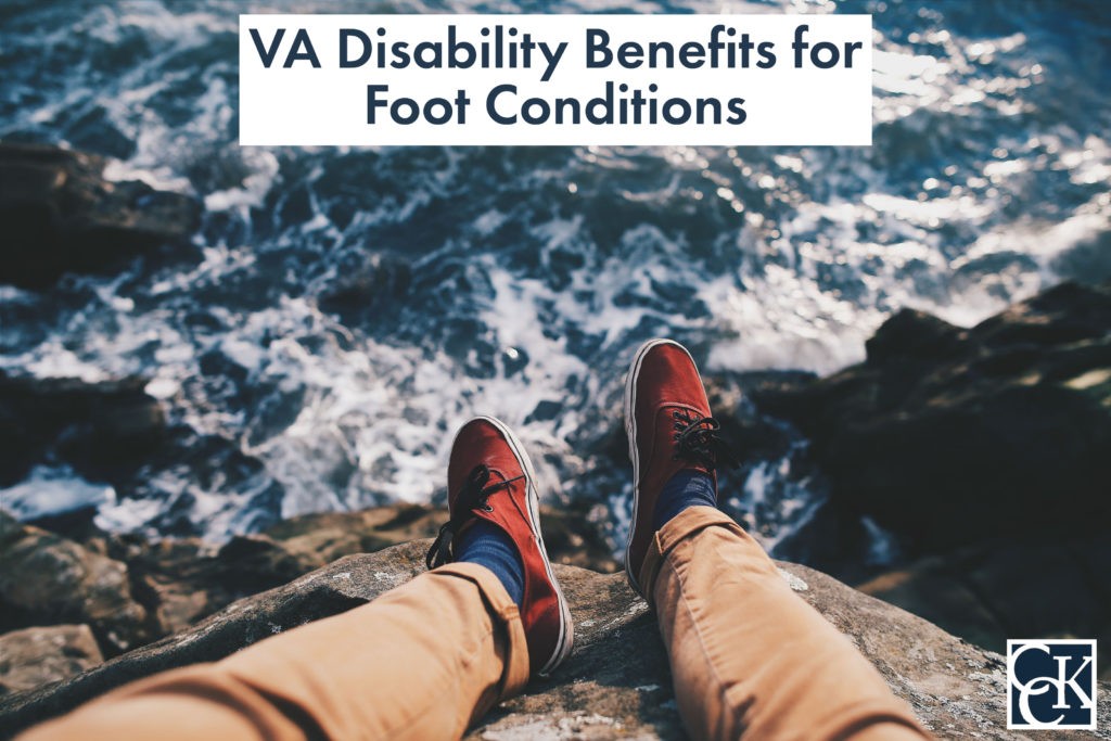 VA Disability Benefits For Foot Conditions CCK Law va-disability-benefits-for-foot-conditions-cck-law