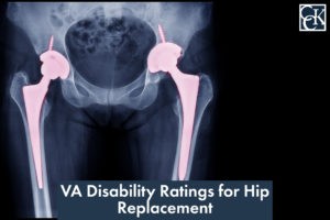 VA Disability Ratings for Hip Replacement