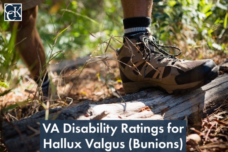 VA Disability Ratings for Hallux Valgus (Bunions)