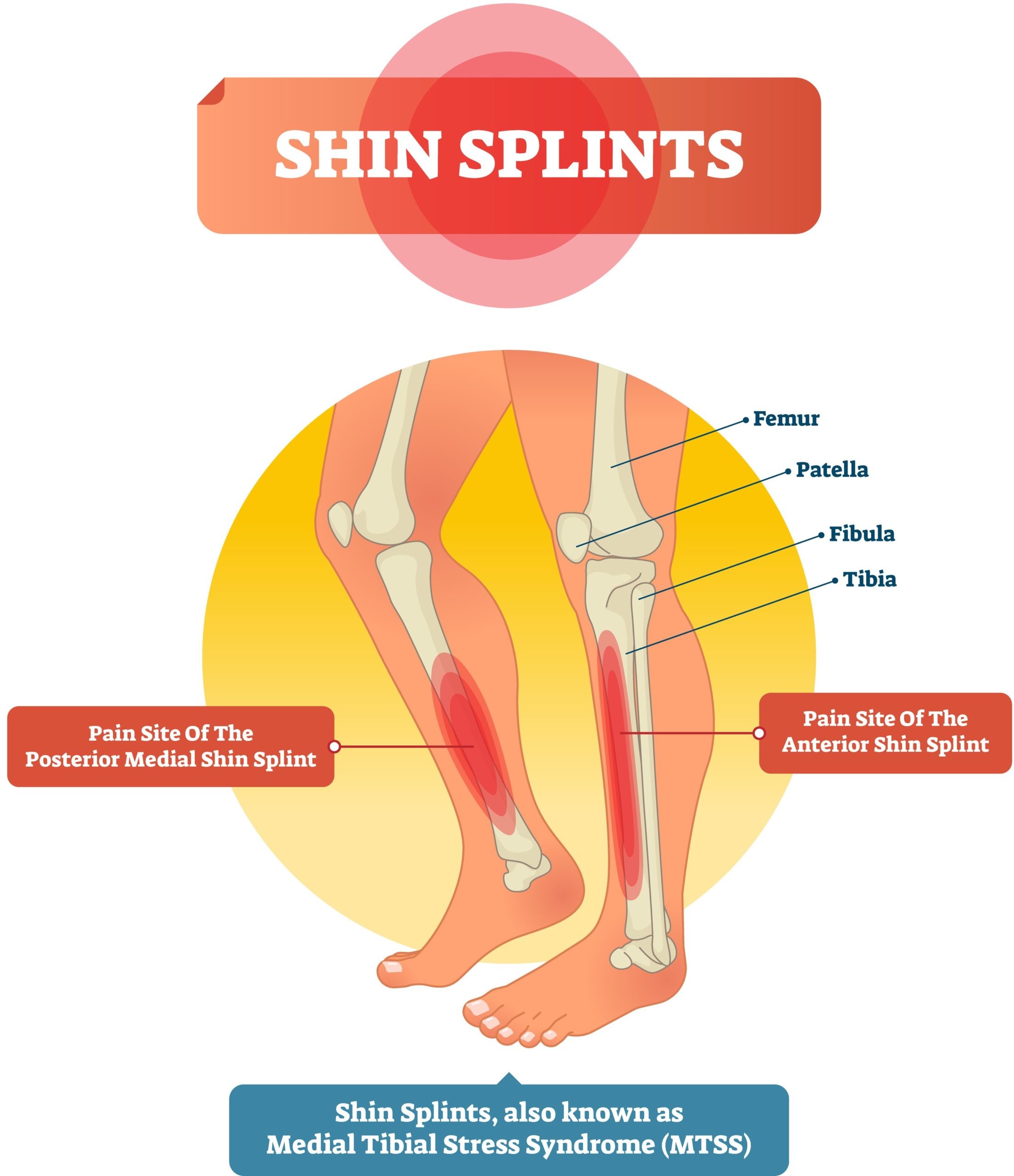 Pain On Front Of Shin Just Above Ankle At Glen Schuman Blog