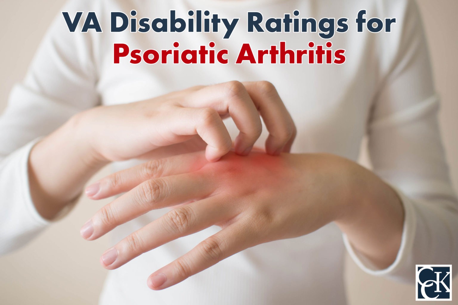 VA Disability Ratings and Benefits for Psoriatic Arthritis | CCK Law