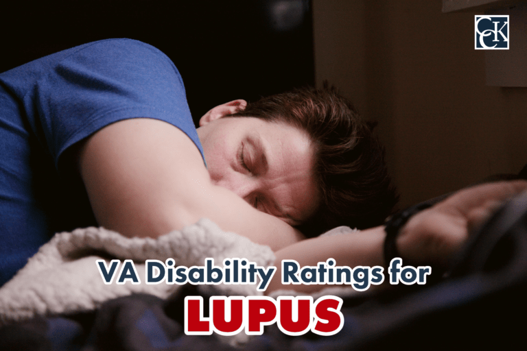 VA Disability Ratings for Lupus