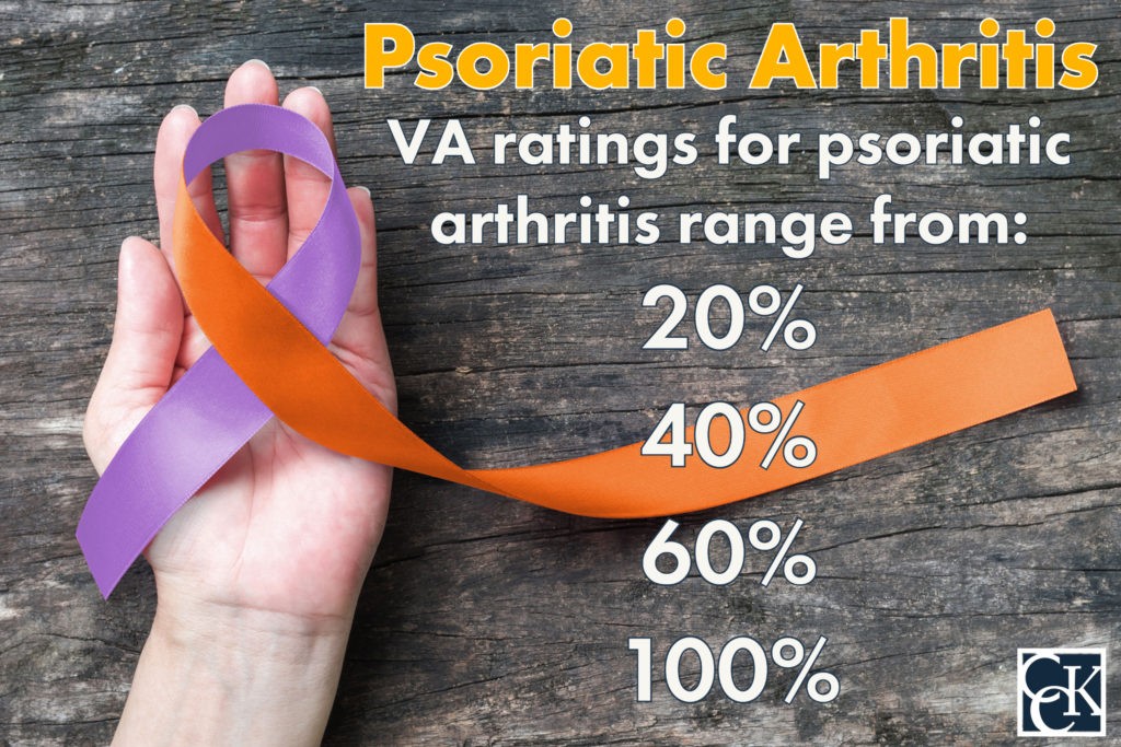 VA ratings for psoriatic arthritis range from: 20% 40% 60% 100%