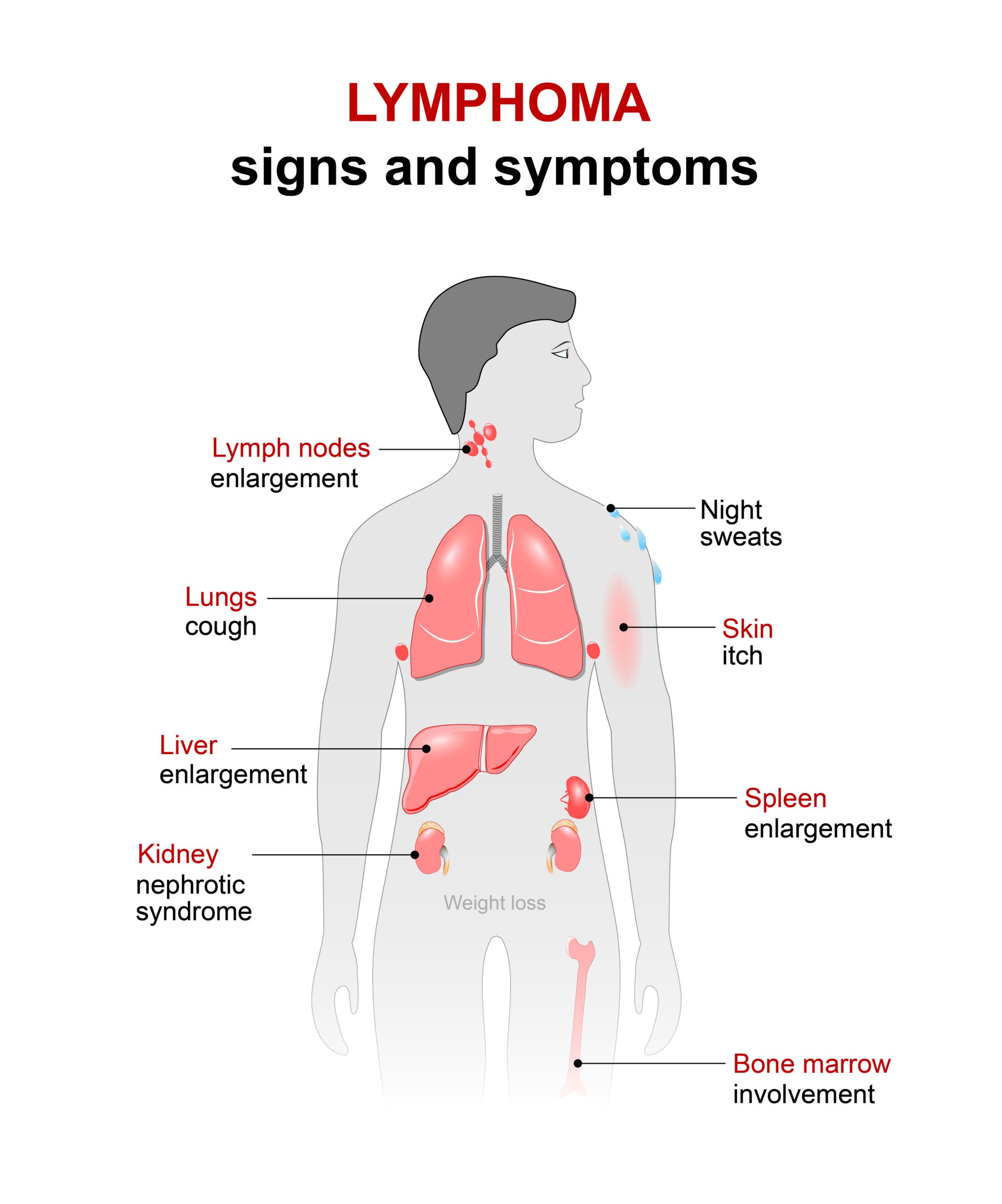 Getting Long Term Disability Ltd Benefits For Lymphoma Cck Law