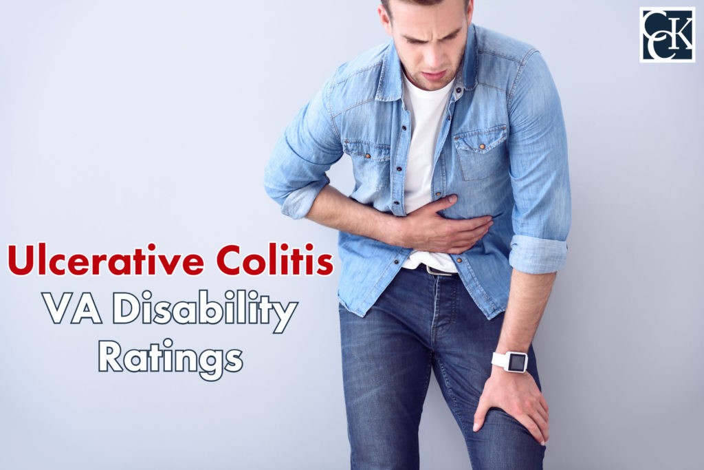 Ulcerative Colitis VA Disability Ratings