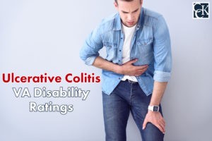 Ulcerative Colitis VA Disability Ratings