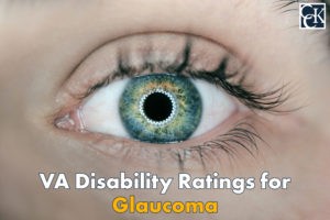 Glaucoma VA Disability Ratings and Benefits