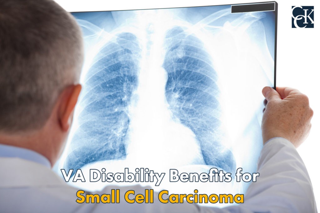 VA Disability Ratings for Small Cell Carcinoma