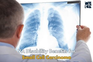 VA Disability Ratings for Small Cell Carcinoma