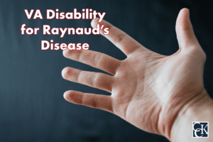 VA Disability for Raynaud’s Disease