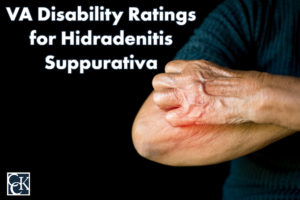 VA Disability Ratings for Hidradenitis Suppurativa