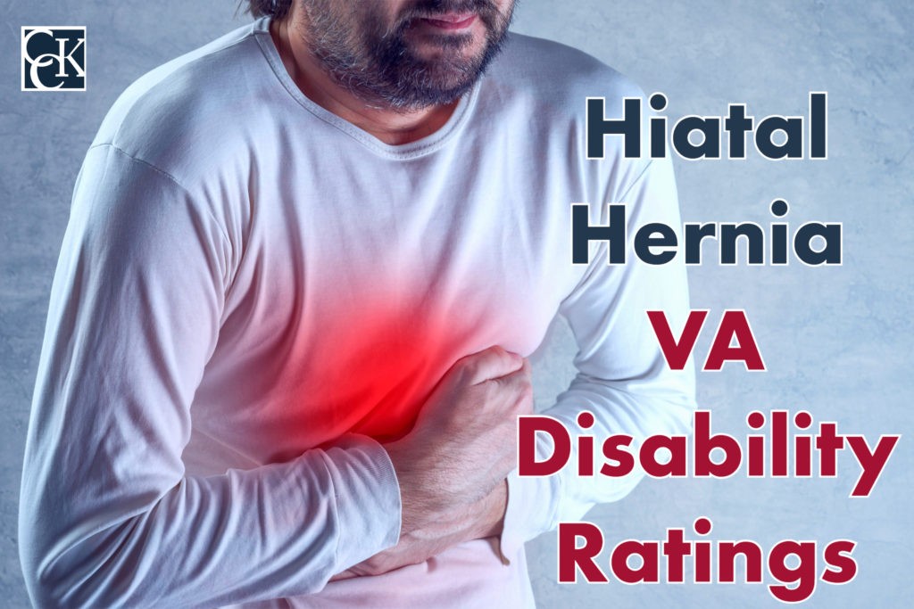 Hiatal Hernia VA Disability Ratings CCK Law
