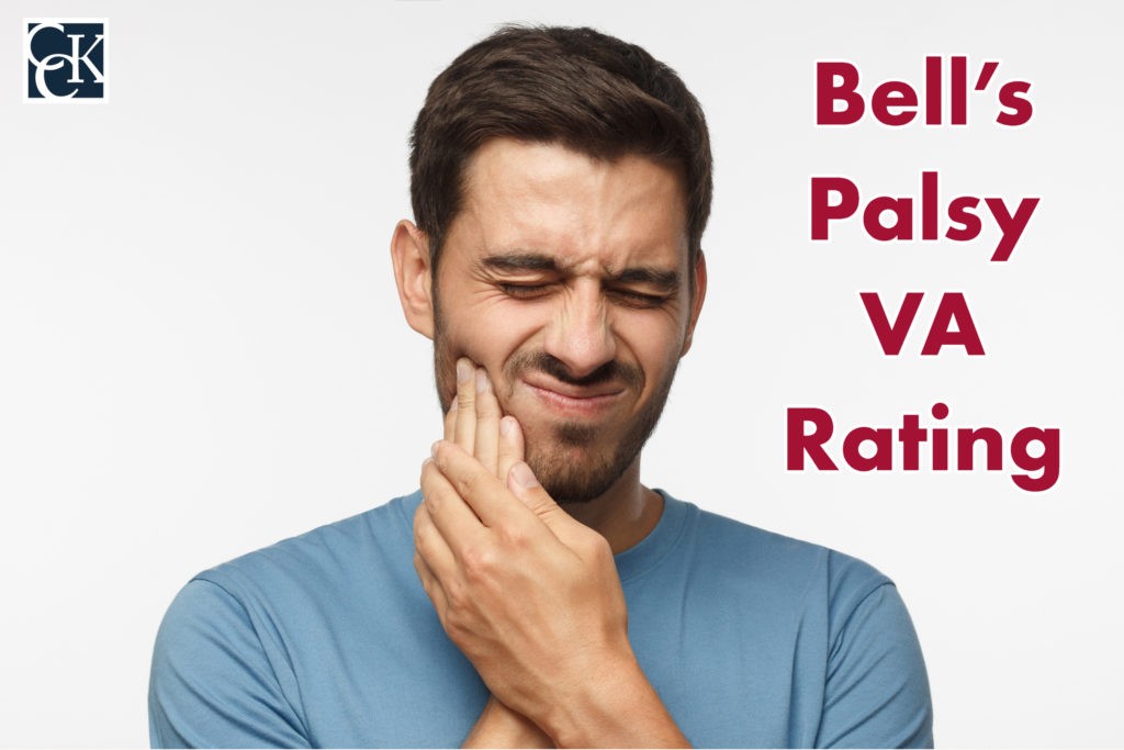 Bell’s Palsy VA Rating
