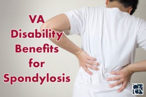 VA Disability Benefits for Spondylosis