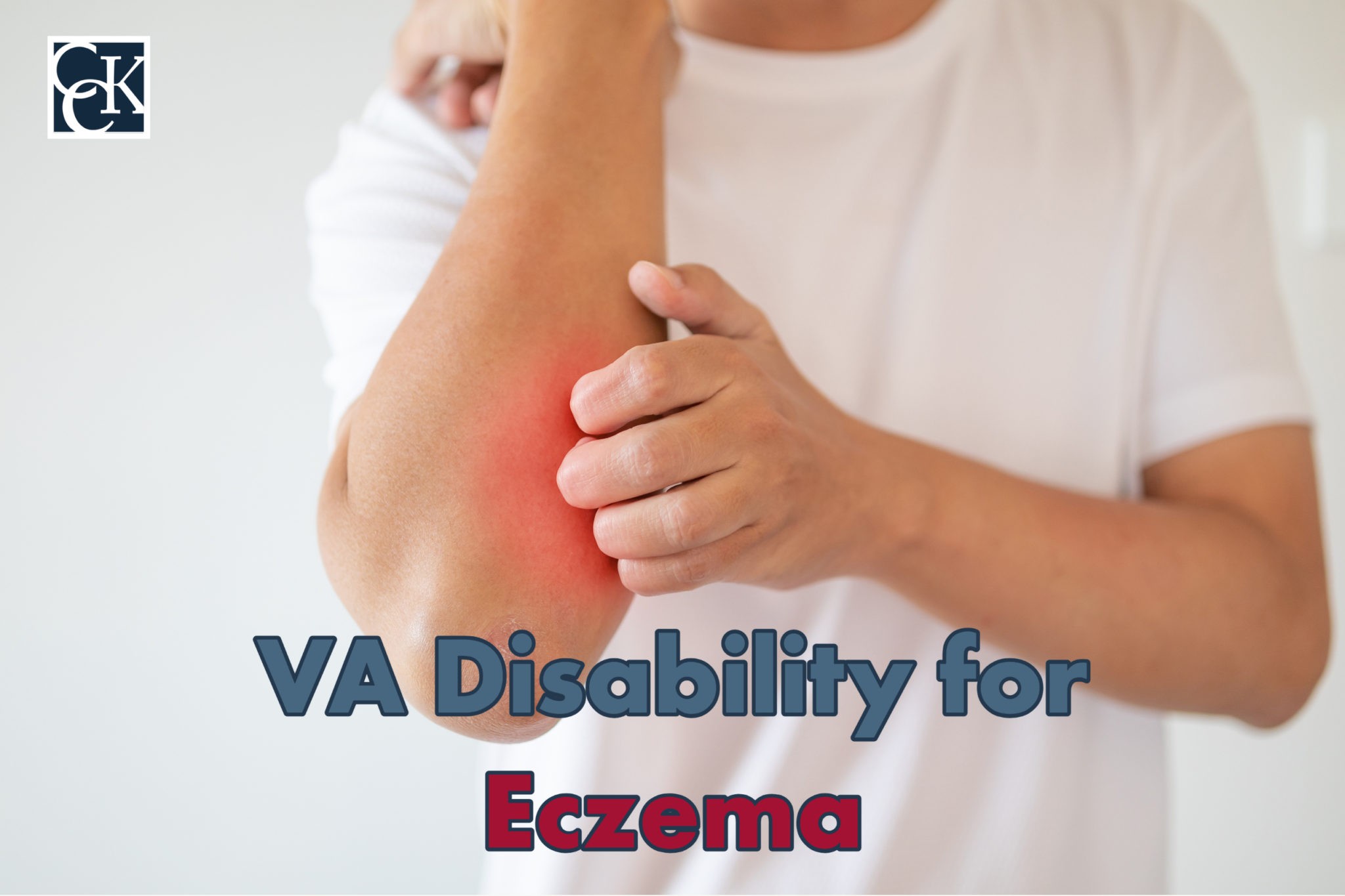 VA Disability for Eczema CCK Law