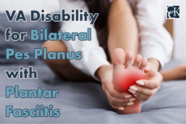 VA Disability for Bilateral Pes Planus with Plantar Fasciitis