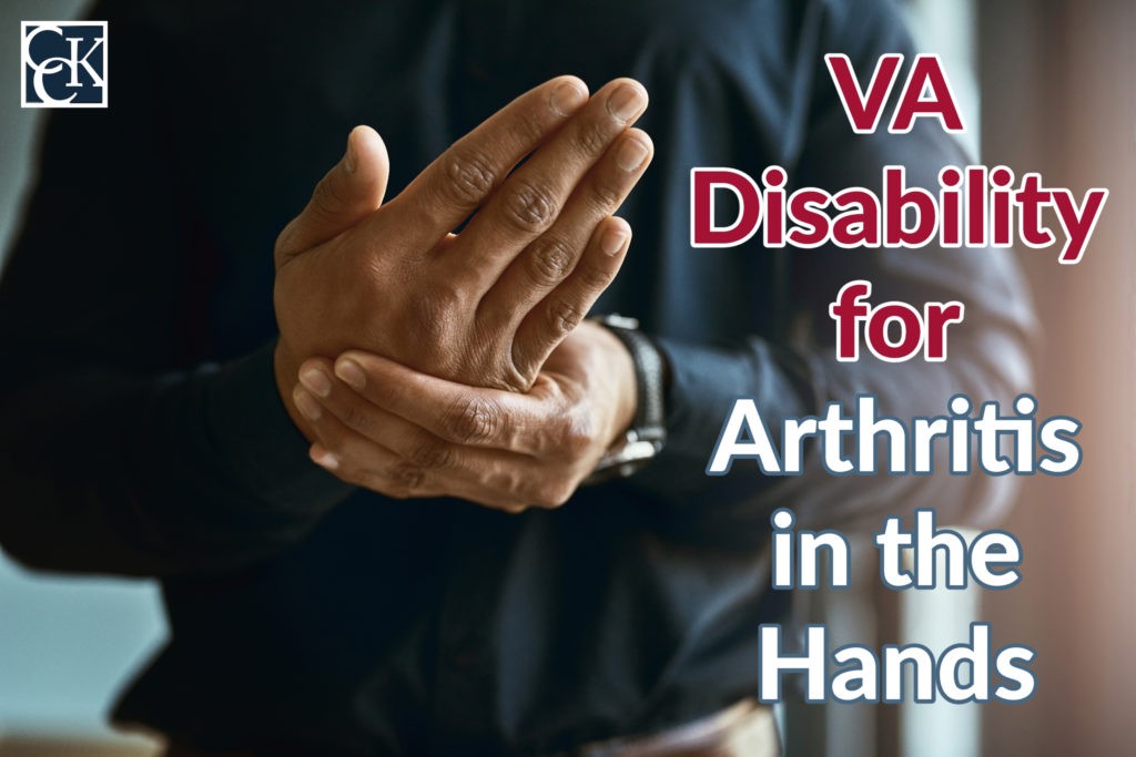 VA Disability for Arthritis in the Hands CCK Law