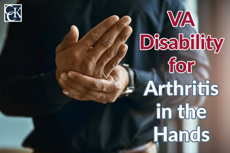VA Disability for Arthritis in the Hands